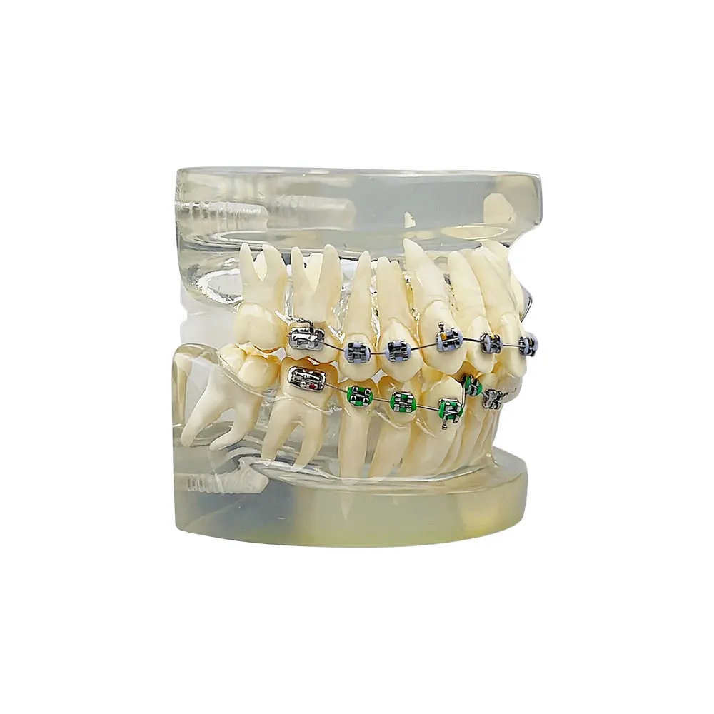 Зъбни зъби Грешна челюст Наполовина метална Половин керамична ортодонтска Модел Стоматологичен модел за зъболекар Студентски преподавателски демонстрационен инструмент Изображение 2