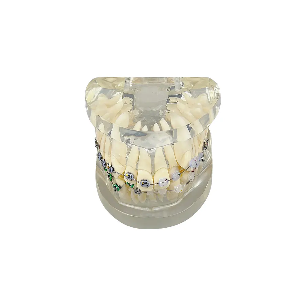 Зъбни зъби Грешна челюст Наполовина метална Половин керамична ортодонтска Модел Стоматологичен модел за зъболекар Студентски преподавателски демонстрационен инструмент Изображение 5
